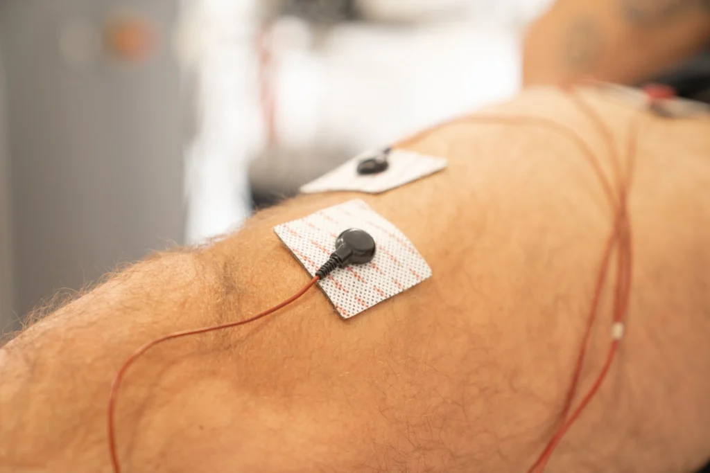 Seduta di elettrostimolazione muscolare eseguita dal fisioterapista